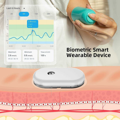 SiBio KS1 CKM (Continuous Ketone Monitoring) System